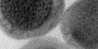 One Nanoparticle, Six Types of Medical Imaging