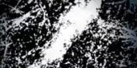 Cancer Cells Don't Move Aimlessly Through the Body