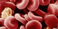 Computer Model of Blood Development Could Speed Up Search for New Leukaemia Drugs
