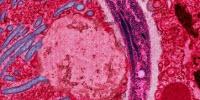 Fighting Malaria More Affordably
