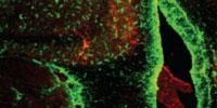 Food for Thought: Master Protein Enhances Learning and Memory