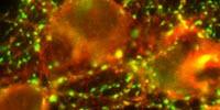New Insight into How Brain Makes Memories