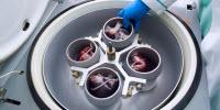Centrifuges: Components of All Blood Bank Operations