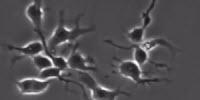 Observing Nature vs. Nurture in Neural Stem Cells