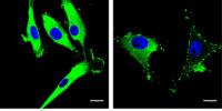 Team Develops New Tagging Technique for Better Cancer Detection