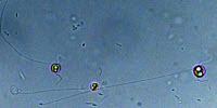 Sequencing Algae’s Genome May Aid Biofuel Production