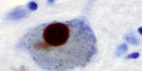 Researchers Face Potential Danger from Protein Particles in the Lab