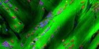 Researchers Resolve Longstanding Issue of Components Needed to Regenerate Muscle