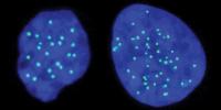 Scientists Generate a New Type of Human Stem Cell That Has Half a Genome