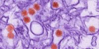 New Mouse Model to Aid Testing of Zika Vaccine, Therapeutics