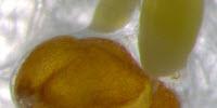 Researchers Find Key to Zinc Rich Plants to Combat Malnutrition