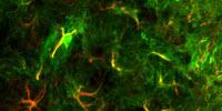 Tiny Microscopes Reveal Hidden Role of Nervous System Cells (Video)