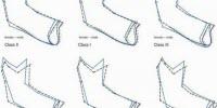 New Data Improve Techniques for Determining Whether a Jaw Bone Comes From a Man or Woman