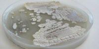 Chemistry Lessons from Bacteria May Improve Biofuel Production