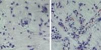Starving Stem Cells May Enable Scientists to Build Better Blood Vessels