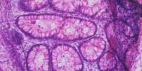 Study Sets Standards for Evaluating Pluripotent Stem Cell Quality