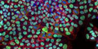 Breakthrough in Scaling up Life-Changing Stem Cell Production