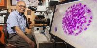 New Clues to Control Spread of Common Parasite