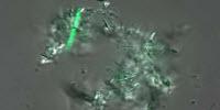 Simple New Test Could Improve Diagnosis of Tuberculosis in Developing Nations