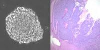 Stem Cells May Speed Up Screening of Drugs for Rare Cancers