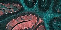 Improving Clinical Specimen Management