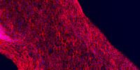 A Step Forward in Building Functional Human Tissues