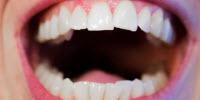 Migraine Sufferers Have More Nitrate-Reducing Microbes in Their Mouths