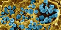 Large Genome Study IDs Potential Virulence Factors to Discriminate New Species
