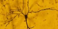 The Late Effects of Stress: New Insights into How the Brain Responds to Trauma
