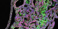 Scientists Tissue-Engineer Part of Human Stomach in Laboratory