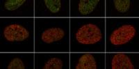 Super-Resolution Imaging Offers Fast Way to Discern Fate of Stem Cells