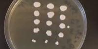 Yeast Found in Babies' Guts Increases Risk of Asthma