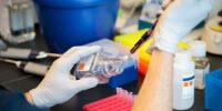 Seemingly Innocuous Virus Can Trigger Celiac Disease
