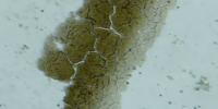 Study Finds Amoeba