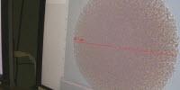Fighting Cancer: New Microscopic Technique Could Help Detect, Diagnose Metastatic Melanomas