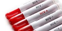 Investigational Vaccine Protected Monkeys from HIV-Like Virus