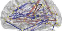 Predicting Autism: Study Links Infant Brain Connections to Diagnoses at Age 2