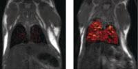 Imaging of Scar Tissue Formation