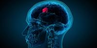 Novel Anti-Cancer Chemotherapeutic Agent Inhibits Glioblastoma Growth and Radiation Resistance
