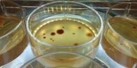 Antibiotic Resistance Rises in 'Lonely' Mutating Microbes
