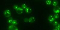 A Fat-Regulating Enzyme Could Hold the Key to Obesity, Diabetes, Cancer, Other Diseases