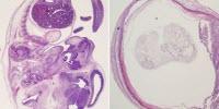 Antibody Protects against Zika and Dengue, Mouse Study Shows