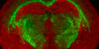 New MALDI Imaging Applications Note