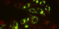 New Yellow Fever Virus Monoclonal Antibodies