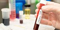 Promising Results for Two Genetic Weapons against Malaria