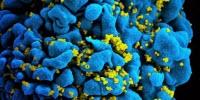 Reengineered Immune System Cells Show Early Promise against HIV
