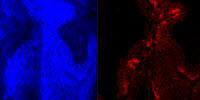 Scientists Develop Experimental “Nano-Chemo” Particle to Treat Bladder Cancer