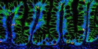 Synthetic Hydrogels Deliver Cells to Repair Intestinal Injuries