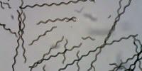 Tiny Robots Step Closer to Treating Hard-To-Reach Parts of the Body