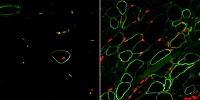UCLA Researchers Create Skeletal Muscle From Stem Cells